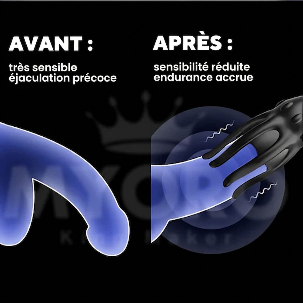 Avant / Après - Neuman Wave Therapy